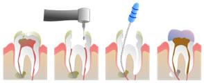 Sunshine Coast Endodontics – Mountain Creek, QLD